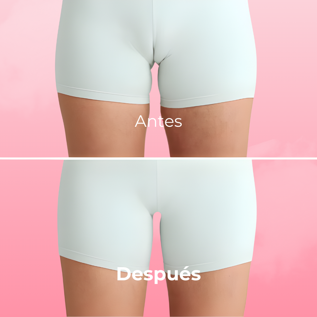 String Anti-Camel Toe